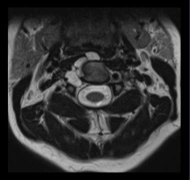 Question Mri Online