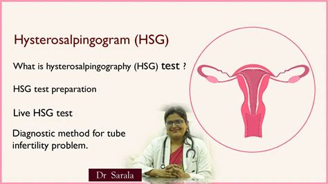 Hsg Test Live Hysterosalpingogram Best Treatment And Diagnostic Method