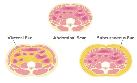 Visceral Fat