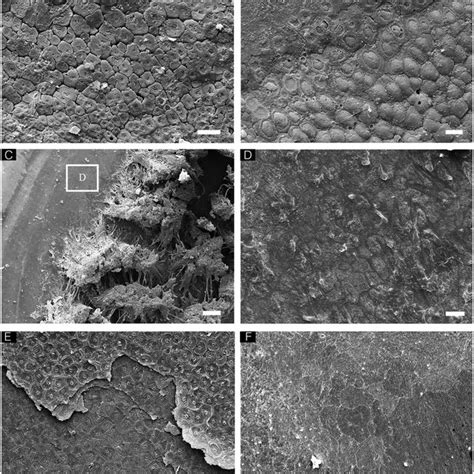 Landmark Based Geometric Morphometric Analysis A SEM Image Of