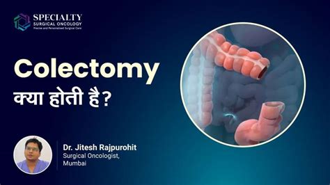 Understanding The Purpose And Procedure Of Colectomy