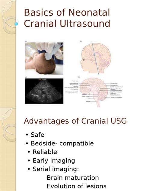 Neonatal Cranial Ultrasound Guide Pdf Skull Nervous System
