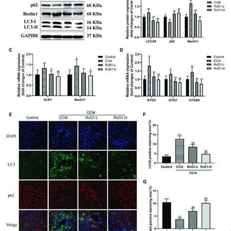 Rvd Alleviated Ccl Induced Liver Fibrosis In Mice By Regulating