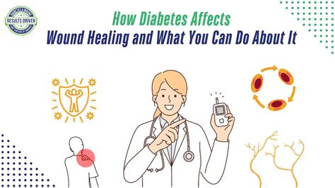 How Diabetes Affects Wound Healing and What You Can Do About It – 2025 ...