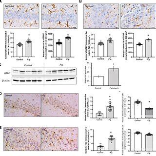 Immunohistochemical analysis of P. gingivalis. P. gingivalis ...