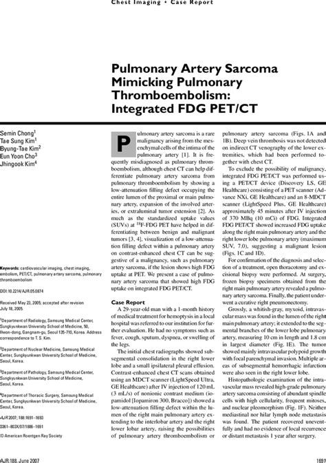 Pulmonary Artery Sarcoma Mimicking Pulmonary Thromboembolism