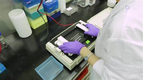 SUMOylation Assay An In Vitro Technique To Detect The SUMOylation