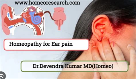 Homeopathy for Ear Pain: Remedies for Common Ear Issues – Homeoresearch.com
