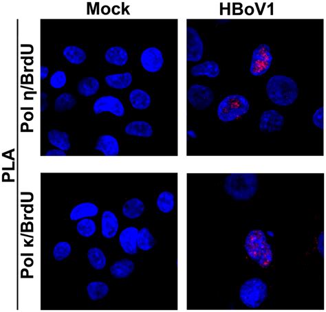 Pol η and Pol κ colocalize with the replicating HBoV1 genome HAE ALI