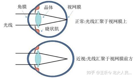 散瞳验光的目的，为什么要散瞳验光，有什么危害 知乎