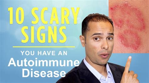 10 Scary Symptoms and Signs You Have an Autoimmune Disease » Reverse Autoimmune