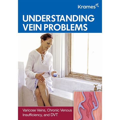 Understanding Vein Problems Krames Patient Education