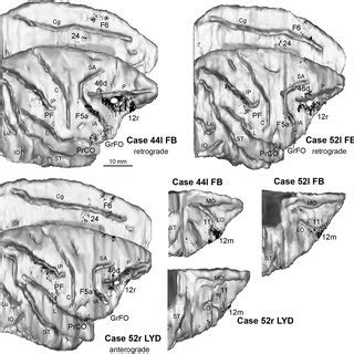 Distribution Of The Retrograde Labeling Observed In Case 44l DY Upper