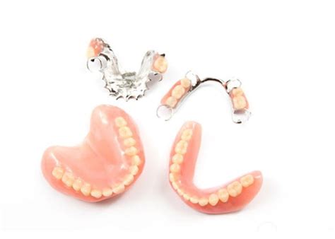 Everything You Need to Know About Partial Dentures