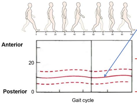 Gait Biomechanics Flashcards Quizlet