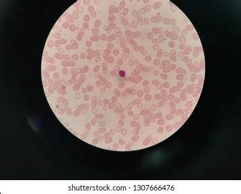 Plasmodium Images, Stock Photos & Vectors | Shutterstock