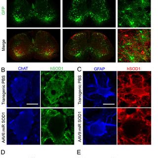 SOD1 expression is suppressed in motoneurons and astrocytes of ...