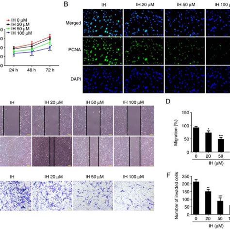 Ih Inhibits The Proliferation Migration Invasion Of Keloid