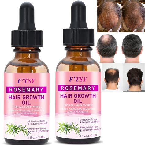 hair growth with argan oil 8