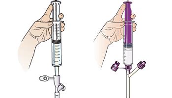 Tube Feeding How To Bolus Syringe Feed Shield HealthCare 54 OFF