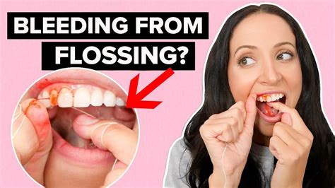 Flossing Teeth Bleeding Gums