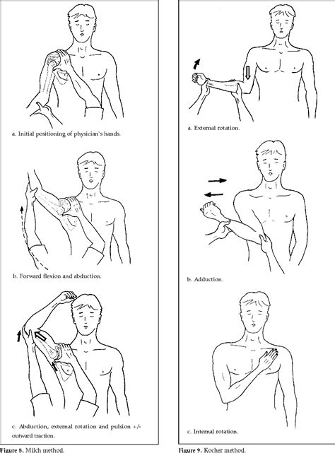 Medicowesome Reduction Of Anterior Dislocation Of Shoulder 44 Off
