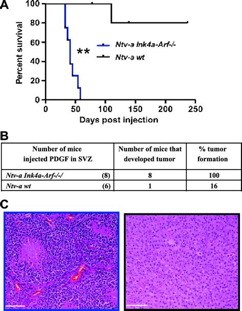 Rcas Tv A System Allows Generation Of Adult Gliomas In The Frontal