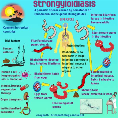 Pathology Of Strongyloidiasis Dr Sampurna Roy Md
