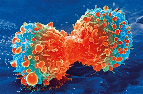malignant tumor