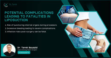 Can Liposuction Cause Death 2025