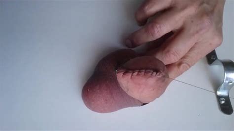 Kinky Guy Sewed His Cock Shut Bizarre Porn At ThisVid Tube