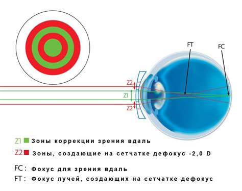 Бифокальные контактные линзы: что это такое, виды, лучшие модели ...