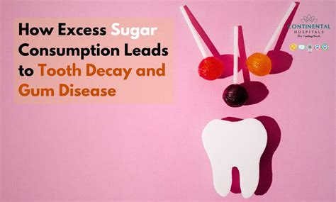 sugar  tooth decay  gum disease