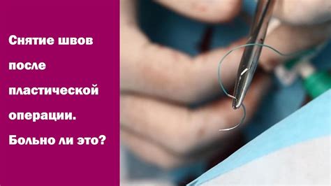 Как зашить рану: Зашить резаные и рваные раны в Санкт-Петербурге
