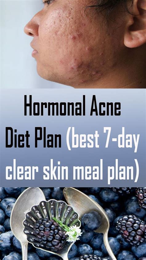 Hormonal Acne Diet Plan Best 7 Day Clear Skin Meal Plan Hormonal