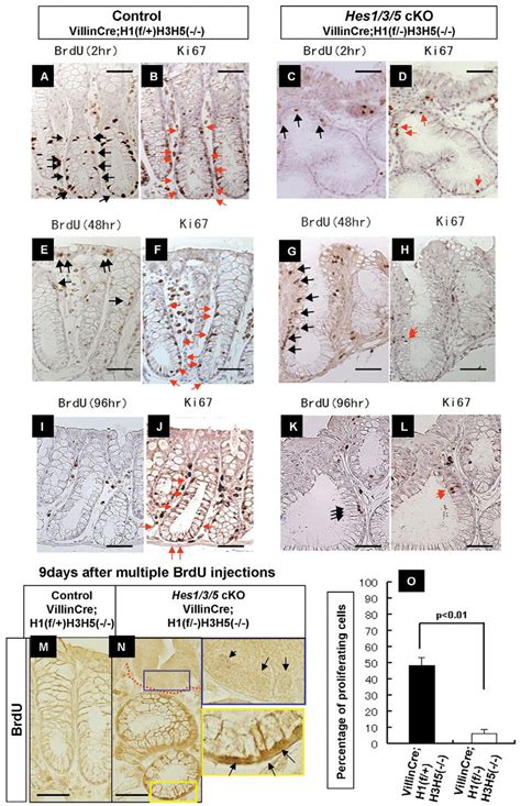 Defects In Cell Proliferation And Migration In The Large Intestine Of