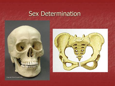 Skeletal Remains Objective To Learn How To Determine Sex And Ethnicity