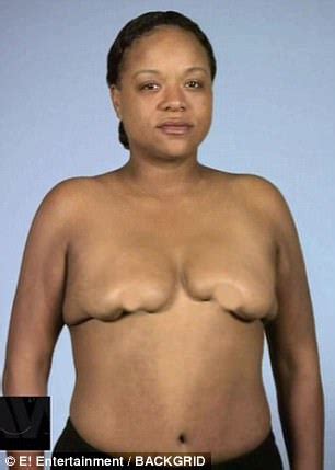 E Botched Patient Celebrates New Breasts With A Boob Cake Daily Mail Online