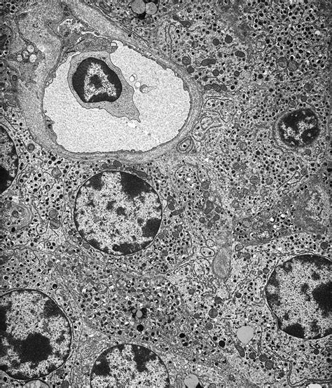 Pancreatic Islet Cells Tem Stock Image C0218383 Science Photo