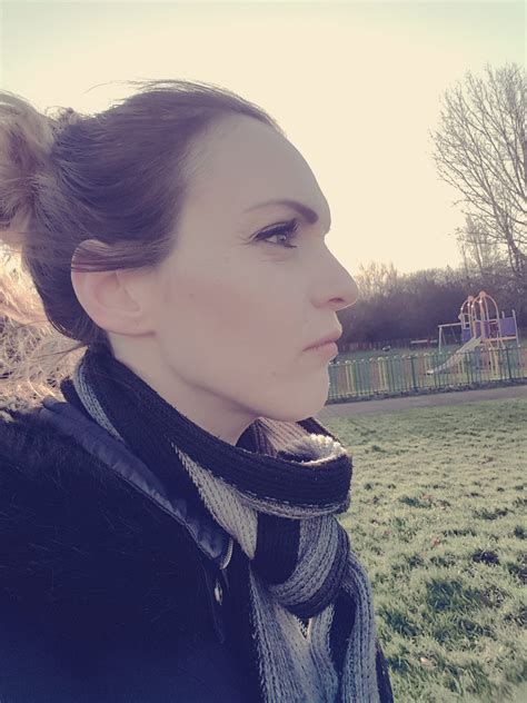 Double Jaw Surgery | The Knight Tribe