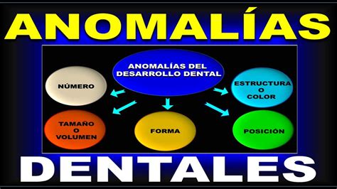 ANOMALIAS DENTALES DEL DESARROLLO YouTube