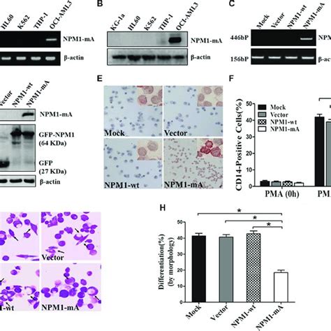 Overexpression Of Mir B Inhibits Myeloid Differentiation Of Hl