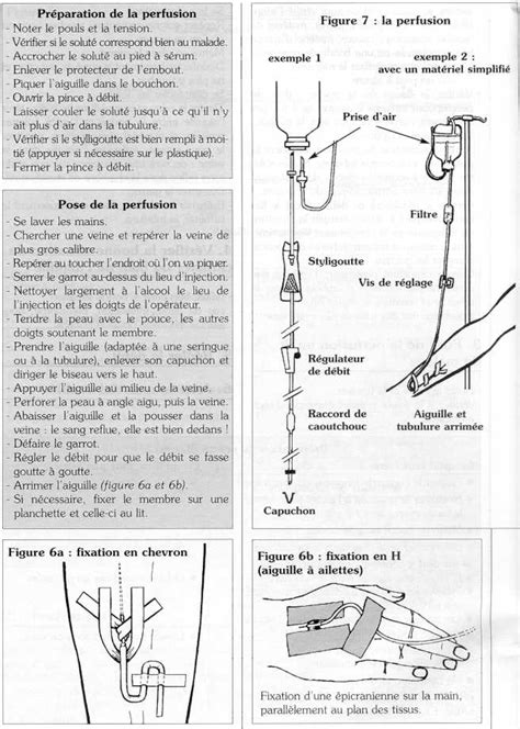 La Perfusion Intraveineuse Devsante Org