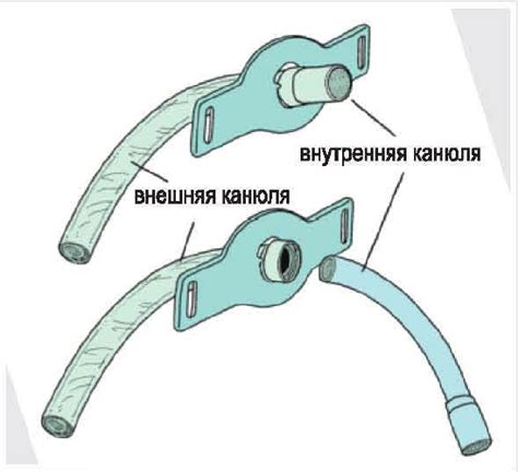 Жизнь с трахеостомой, аксессуары которые могут ее упростить ...