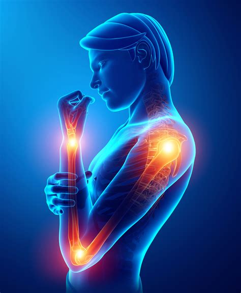 Arm And Hand Pain At Night In Bed at Jerry Fagan blog