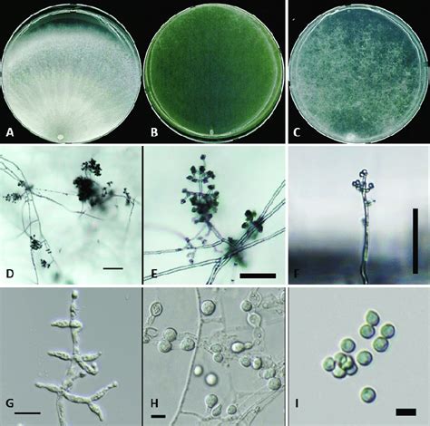 Trichoderma Paraviridescens NNIBRFG1772 Colony Morphology On Potato