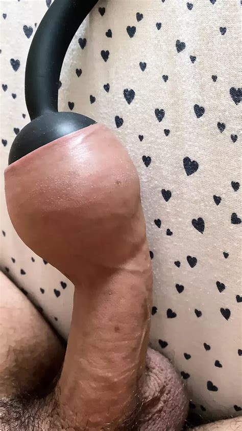 Foreskin Extreme Air Inflation Porn Gay Amateur Porn XHamster