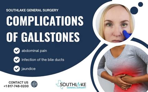 Treatment For Gallstones Symptoms Causes Risks And Options