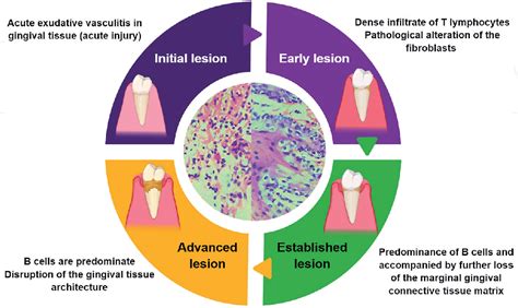 Figure 3 From Pathogenesis Of Periodontal Disease Semantic Scholar