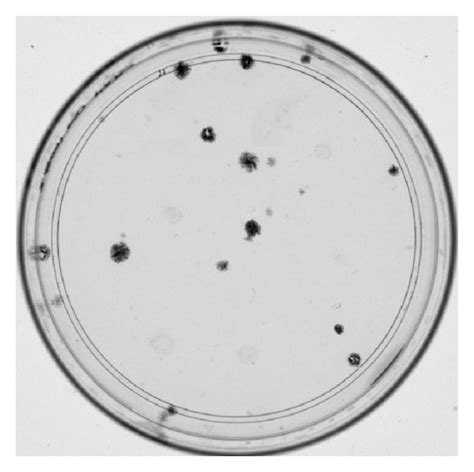 Colony Forming Unit Assay Of Ebm Mscs Representative Image Of Cfu Download Scientific Diagram